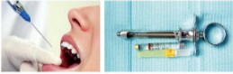 胰島素，牙科麻醉6.png